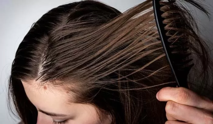 چرب شدن مو (Hair Greasiness)
