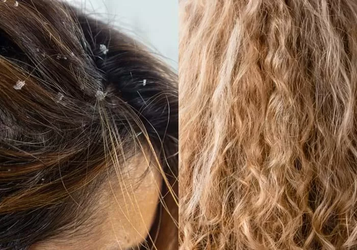 تخلخل (Porosity)
