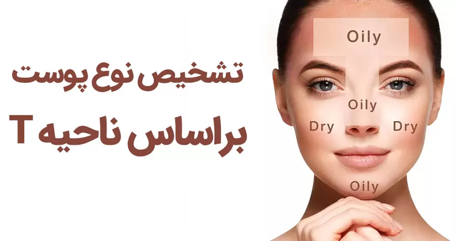 نقطه T صورت