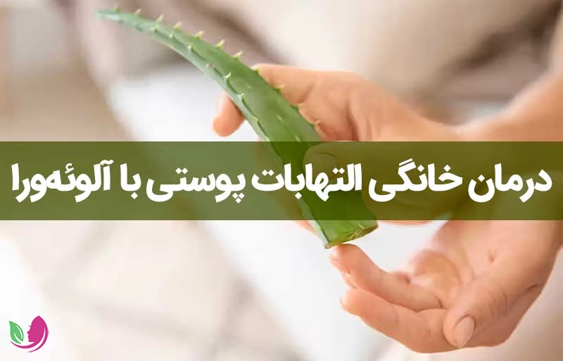 درمان خانگی التهابات پوستی با آلوئهورا